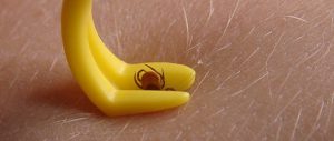 enlever une tique tire-tique outil retirer une tique pince pour tique